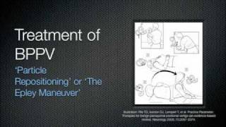 BPPV Education Video 2011wmv [upl. by Aizek]