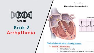 KROK 2  Arrhythmia All Types amp related NEW Krok questions [upl. by Tymes]