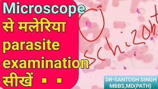 Examine Malaria Parasite Under microscopic  मलेरिया स्लाइड टेस्ट  PVivex  PFr  Ring Form [upl. by Atalayah370]