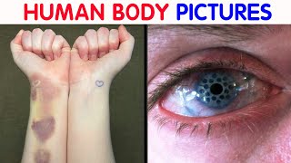 “My Eye Is Gradually Losing Its Color” 50 Interesting Human Body Pics [upl. by Areemas]