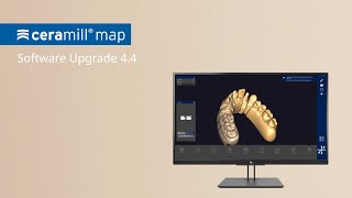 Ceramill Mind Upgrade 44  Ceramill Map [upl. by Silsby]