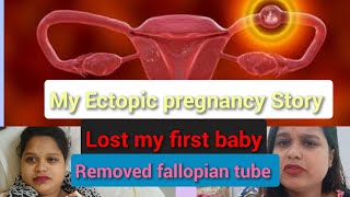 My Ectopic pregnancy story  Lost my first baby meri death bhi ho skti thi  Emergency operation [upl. by Selinski]