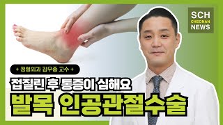 접질린 후 통증이 심해요 발목 인공관절수술 ㅣ 정형외과 김우종 교수 [upl. by Hernardo]