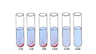 Widal test [upl. by Anson]