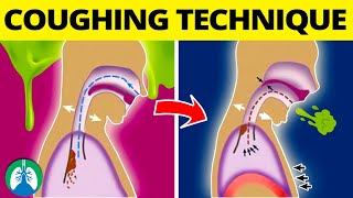 This COUGHING Technique Can Help Get Rid of Mucus and Phlegm ❗ [upl. by Higinbotham]