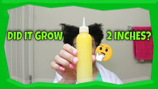 Aloe Vera Hair Growth Serum  Aloe Vera For Hair Growth Natural Hair [upl. by Onirefez240]