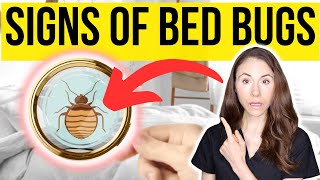 Signs You Have Bed Bugs And How To Get Rid Of Them [upl. by Charleton]