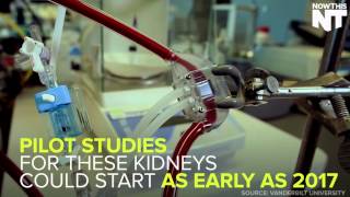 Artificial Kidney Could Free Patients From Dialysis [upl. by Azil]