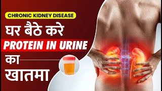 पेशाब में झाग कैसे रोके  Protein In Urine Treatment  Dr Pragti Gupta [upl. by Sverre]