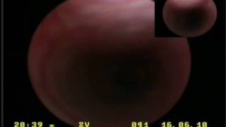 Tracheobronchoscopy in a dog tracheal collapse wwwendovetsu [upl. by Yllah]