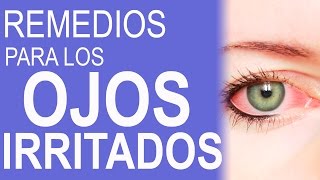 REMEDIOS CASEROS PARA LOS OJOS ROJOS E IRRITADOS  COMO HACER GOTAS PARA LOS OJOS ROJOS [upl. by Arim]