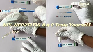 HOW TO DO HIV HEPATITIS B amp HEPATITIS C Tests Yoursef [upl. by Ilan]