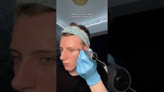 Microneedling at home with me  skincare skin microneedling acne home [upl. by Ahsia]