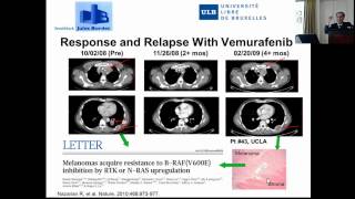 Ahmad Awada Thérapie biologique ciblée du mélanome [upl. by Lorianne]
