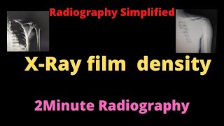 X Ray film density ll Radiographic density ll 2 minute Radiography ll Radiography Simplified [upl. by Ursula886]