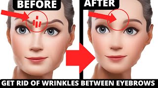 HOW TO GET RID OF FROWN LINES BETWEEN EYEBROWS  ANTIAGING FACE EXERCISES FOR FROWN LINES [upl. by Signe]