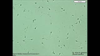 Sperm Motility Assessment exercise 4 [upl. by Nibur]