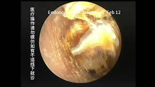 Differences in 3 types of ear conditions [upl. by Landan411]