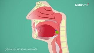 Dysphagie troubles de la déglutition et Fausse route questce que cest [upl. by Paulette]