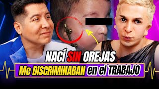 ¡NACÍ SIN OREJAS👂 TENGO SÍNDROME de TREACHER COLLINS  Diagnóstico 59  Mr Doctor [upl. by Balf]