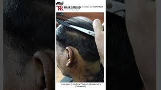 most natural looking hair patch hairpatchformen hairreplacement nonsurgicalhairreplacement [upl. by Algie859]