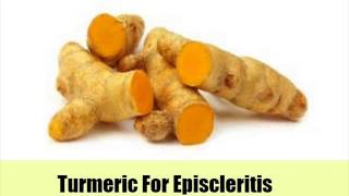 9 Top Natural Cures For Episcleritis [upl. by Handel877]