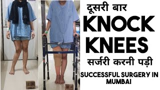 Unsuccessful surgery of knock knee Dr namisha did again right knock knee surgery in mumbai [upl. by Waterer722]