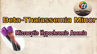 BetaThalassemia Minor ll Microcytic Hypochromic Anemia ll Hematology And Blood Banking [upl. by Andros]