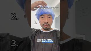 Hair transplant COST  hairtransplant hairtransformation fue beforeandafter balding [upl. by Elocen]