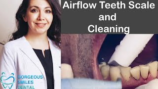 Airflow Teeth Scale and Cleaning [upl. by Lyrrehs]