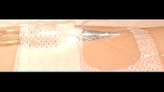 Peripheral IV Dressing Change Tegaderm™ IV Advanced [upl. by Dazhehs990]