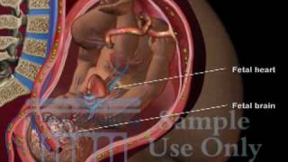 Umbilical Cord Compression  Maternal Fetal Circulation Medical 3D Animation [upl. by Neerhtak]