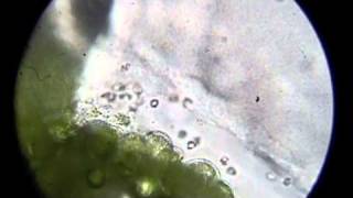 Ceratopteris gametophytes and sperm [upl. by Brenden999]