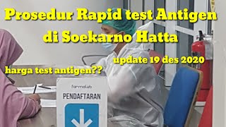 PROSEDUR RAPID TEST ANTIGEN amp HARGA DI BANDARA SOEKARNO HATTA  UPDATE 19 DES 2020 [upl. by Atiuqam]