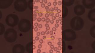 Malaria parasite 😱science pathology biology shortvideo dmlt viral tranding malariaparasites [upl. by Suzann]