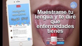 ¿Sabes que es el diagnostico de LENGUA Muéstrame tu lengua y te diré que enfermedades tienes 🔍👅 [upl. by Merwin615]